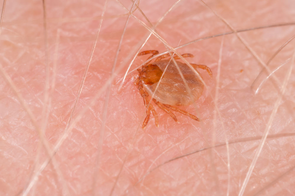 Biên trùng do Anaplasma - Hình ảnh minh họa